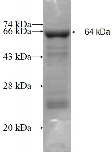 Recombinant Human RASA3 SDS-PAGE