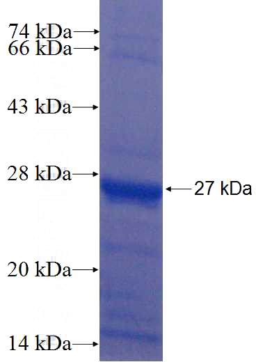 Recombinant Human MYO18B SDS-PAGE