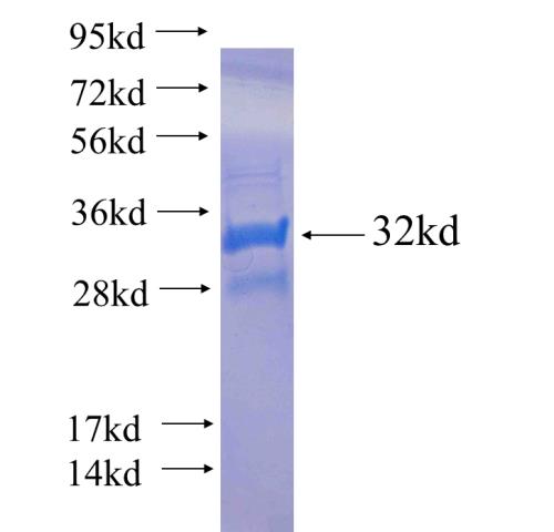 Recombinant human FLVCR2 SDS-PAGE