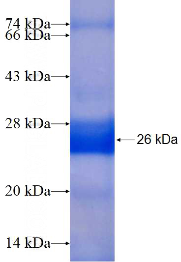 Recombinant Human ALG14 SDS-PAGE