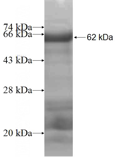 Recombinant Human THBD SDS-PAGE