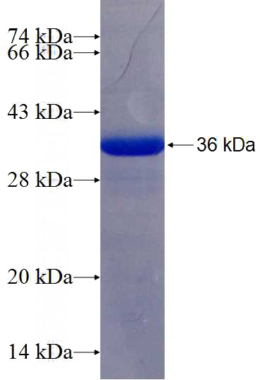 Recombinant Human MYO10 SDS-PAGE