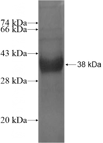 Recombinant Human RBM11 SDS-PAGE