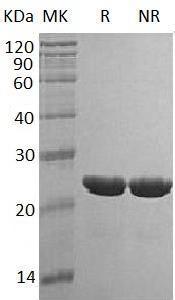 Human TMPO/LAP2 (His tag) recombinant protein