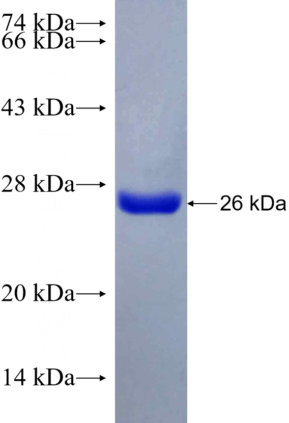 Recombinant Human COX1 SDS-PAGE