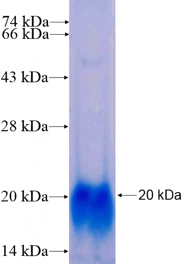 Recombinant Human CRYBB3 SDS-PAGE