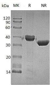 Human CTSZ (His tag) recombinant protein