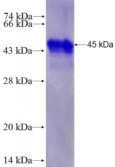 Recombinant Human IL-11RA SDS-PAGE