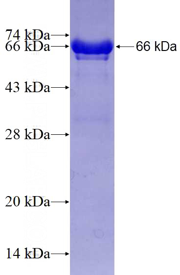 Recombinant Human PTBP1 SDS-PAGE