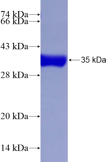 Recombinant Human SFRS6 SDS-PAGE