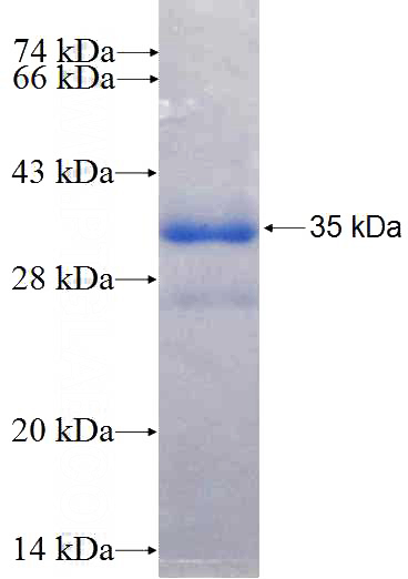 Recombinant Human DSCR3 SDS-PAGE