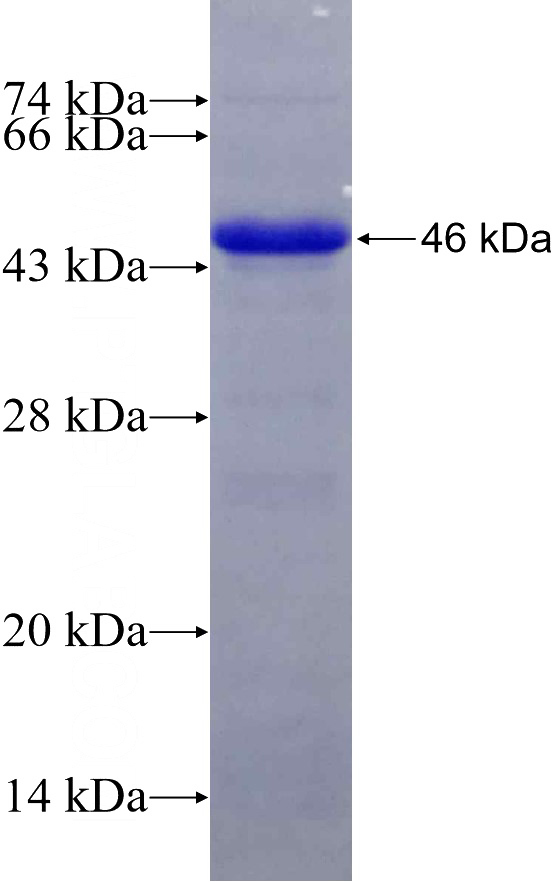Recombinant Human Integrin alpha-E SDS-PAGE