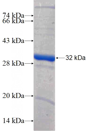 Recombinant Human TIGAR SDS-PAGE