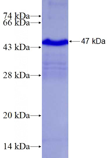 Human TNFRSF9 Recombinant protein (GST tag)