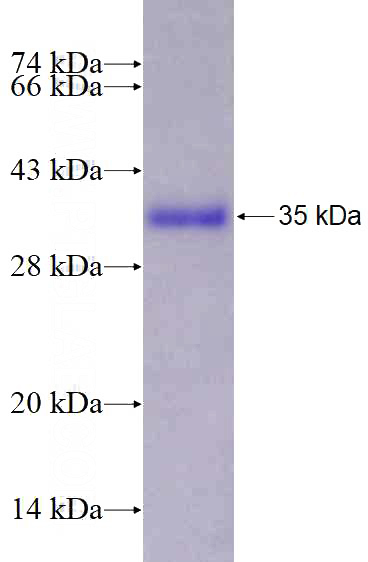 Recombinant Human TTK SDS-PAGE