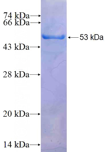 Recombinant Human RBM38 SDS-PAGE