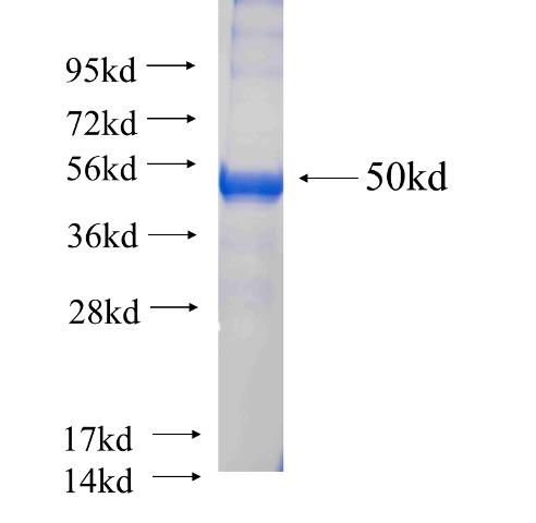 Recombinant human RAB38 SDS-PAGE