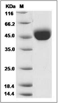 Human LRG1 Protein (His Tag) SDS-PAGE