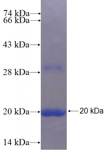 Recombinant Human PDCD5 SDS-PAGE