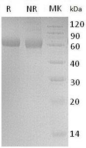Human RTN4RL1/NGRH2/NGRL2 (His tag) recombinant protein