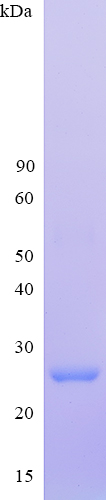 Recombinant Human RNF135 SDS-PAGE