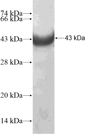 Recombinant Human GJA8 SDS-PAGE