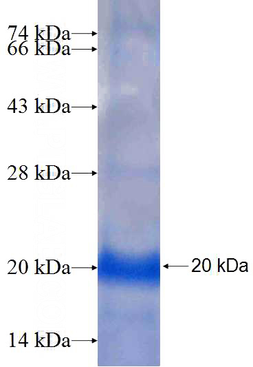 Recombinant Human UBE2Q1 SDS-PAGE