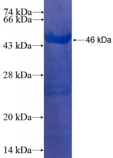 Recombinant Human TAF9 SDS-PAGE