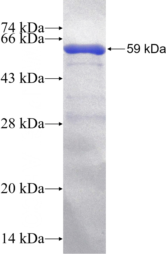 Recombinant Human PLXNB2 SDS-PAGE