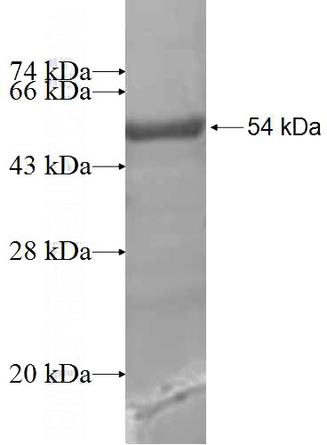 Recombinant Human SATB1 SDS-PAGE