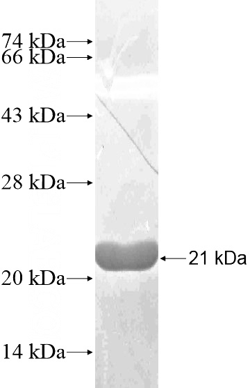 Recombinant Human ARPP-19 SDS-PAGE