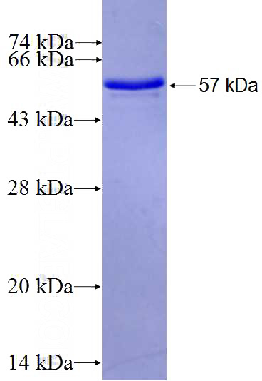 Recombinant Human PRSS7 SDS-PAGE