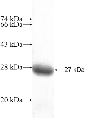 Recombinant Human RABL2A SDS-PAGE