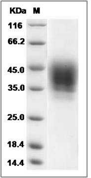 Rat CD48 / SLAMF2 / BCM1 Protein (Fc Tag) SDS-PAGE