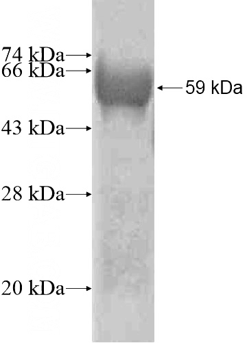 Recombinant Human STARD10 SDS-PAGE