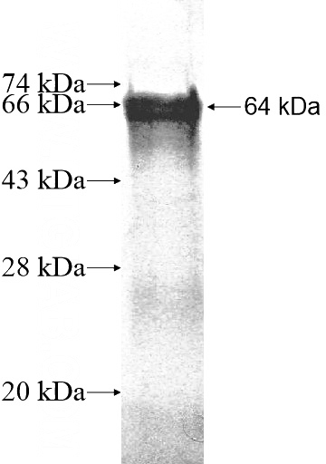 Recombinant Human DGKQ SDS-PAGE