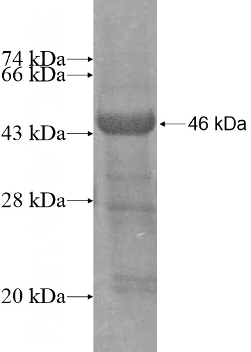 Recombinant Human PSTK SDS-PAGE