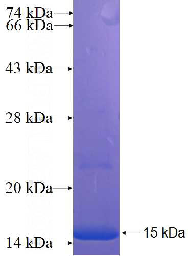 Recombinant Human ANKRD54 SDS-PAGE