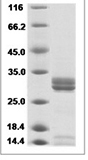 Enterovirus D68 (EV-D68) (strain Fermon) VP4 Protein (Fc Tag)