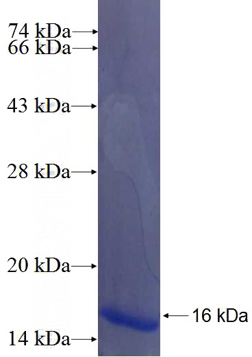 Recombinant Human ANKRD40 SDS-PAGE