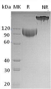 Mouse Sell/Lnhr/Ly-22/Ly22 (His tag) recombinant protein