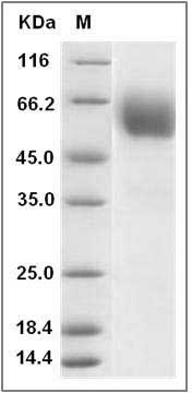 Rat CD47 Protein (Fc Tag) SDS-PAGE