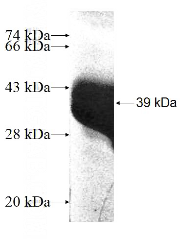 Recombinant Human MCM3 SDS-PAGE