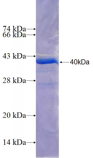 Recombinant Human BSN SDS-PAGE
