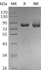 Human THOP1 (His tag) recombinant protein