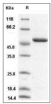 Human ENO1 / Enolase 1 / alpha-enolase Protein (His Tag) SDS-PAGE