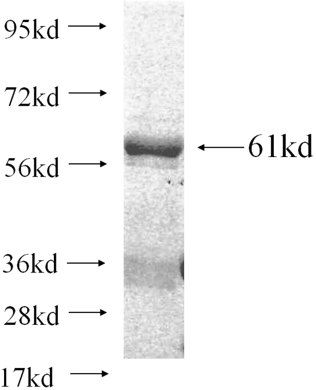 Recombinant Human LZTFL1 SDS-PAGE