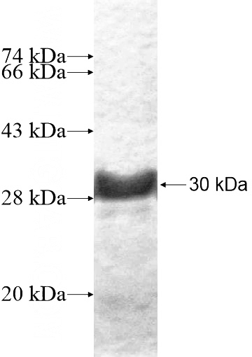 Recombinant Human MXD4 SDS-PAGE