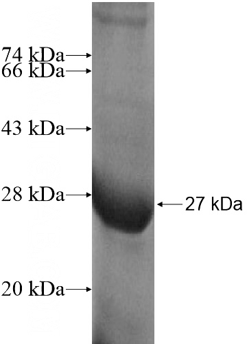 Recombinant Human RASL10B SDS-PAGE