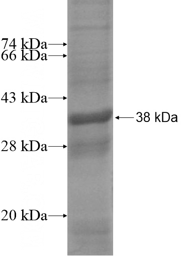 Recombinant Human RDRC SDS-PAGE